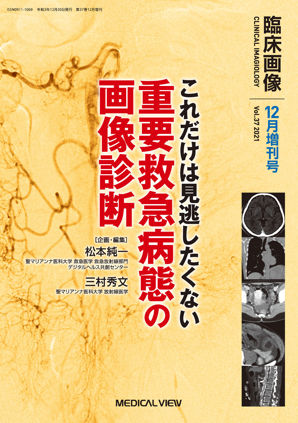 メジカルビュー社｜臨床画像特集一覧｜臨床画像 2021年12月増刊号