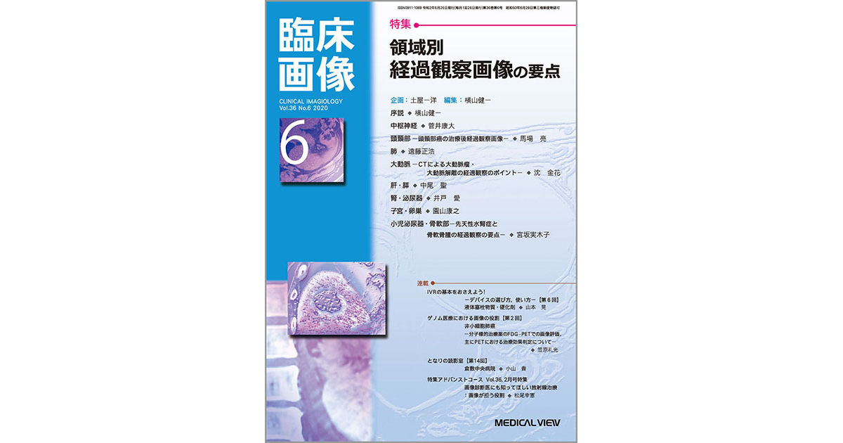 メジカルビュー社｜臨床画像特集一覧｜臨床画像 2020年6月号