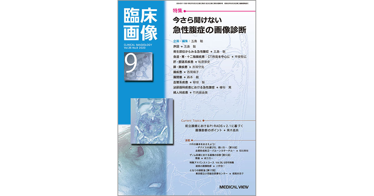 急性腹症のCT 連続スライスで学ぶ レジデントのための急性腹症のCT[Web付録付
