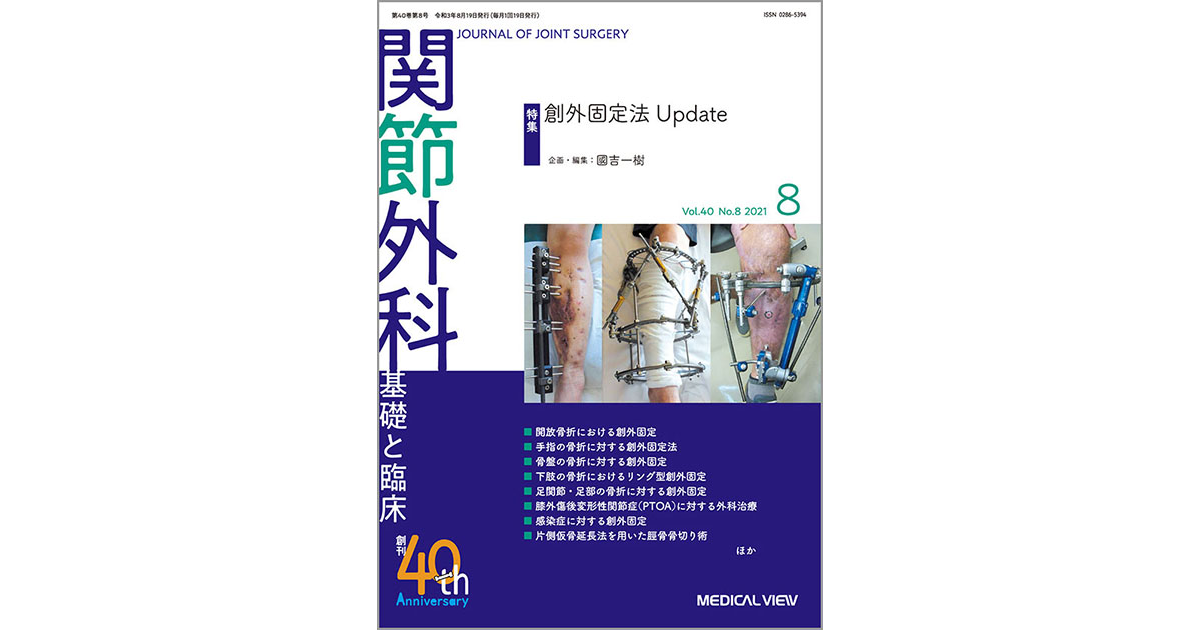 メジカルビュー社｜関節外科特集一覧｜関節外科 2021年8月号