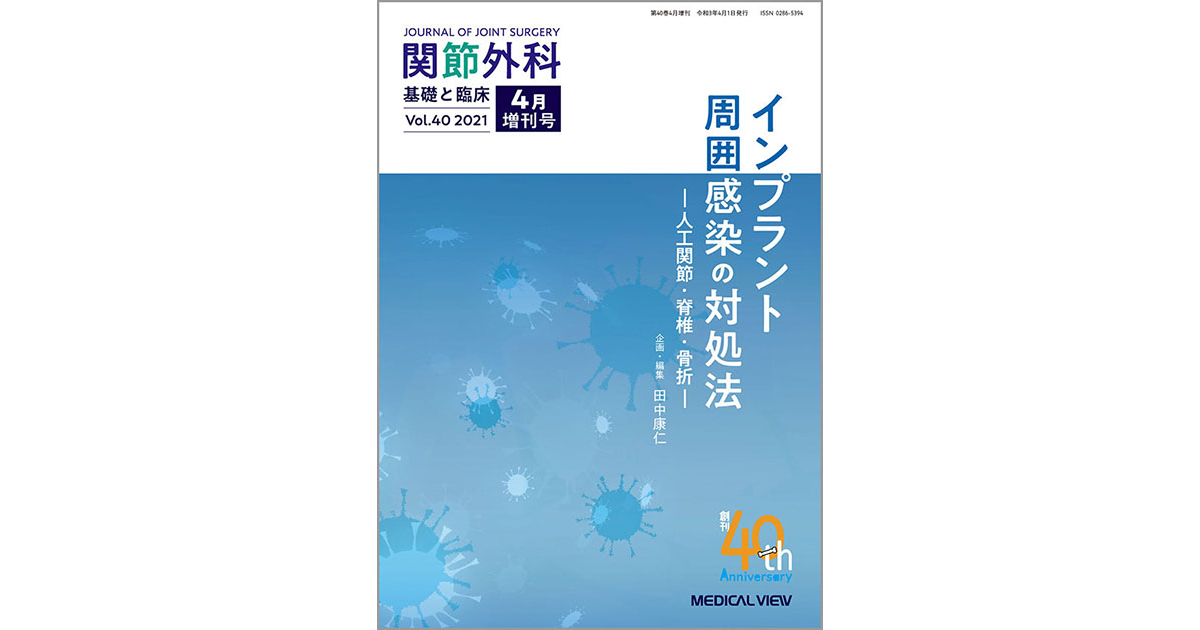 メジカルビュー社｜関節外科特集一覧｜関節外科 2021年4月増刊号