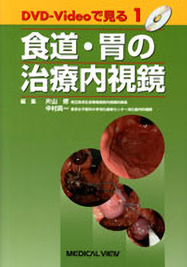 DVD-Videoで見る治療内視鏡(全3巻)