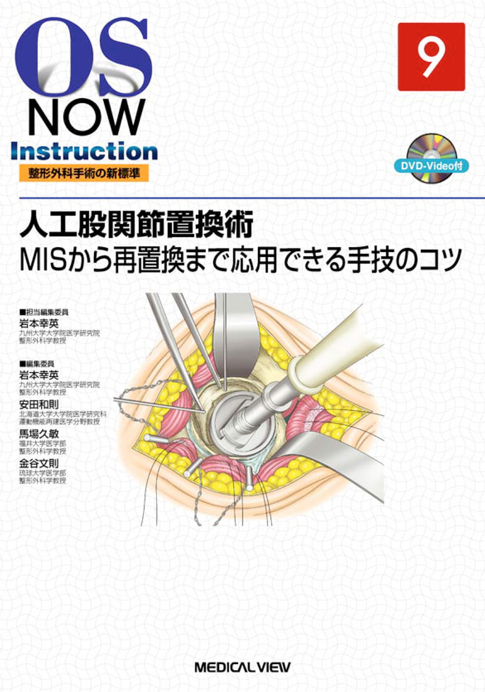 新OS now no.21―新世代の整形外科手術 スポーツ整形外科の手術 (新OS NOW新世代の整形外科手術 No. 21) 清水 克時