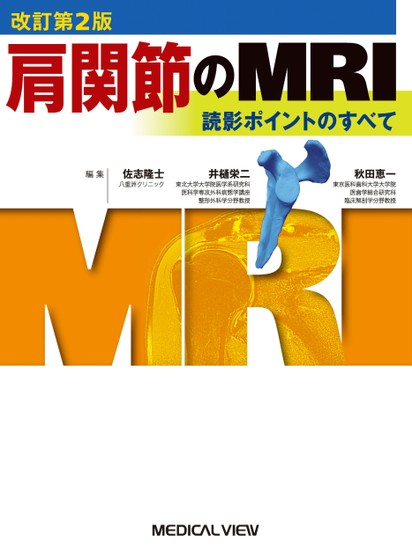 肩関節のMRI 改訂第2版