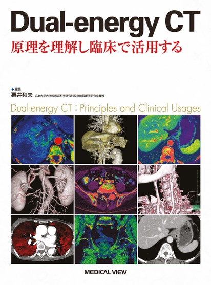 Amazon.com: Dual-energy CT 原理を理解し臨床で活用する