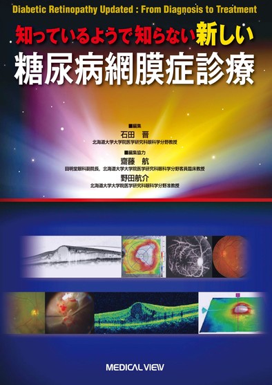 知っているようで知らない新しい糖尿病網膜症診療 知っているようで知らない 新しい 糖尿病網膜症診療