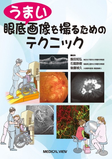 うまい眼底画像を撮るためのテクニック | 飯田 知弘, 石龍 鉄樹