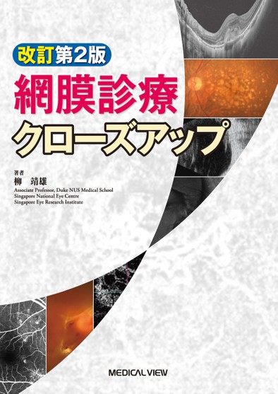網膜診療クローズアップ 改訂第2版 | 柳 靖雄 |本 | 通販 | Amazon