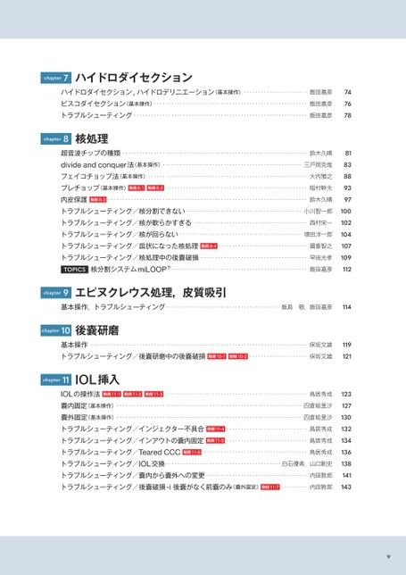 スタンダード白内障手術 メジカルビュー社｜Movie Archives｜『スタンダード白内障手術