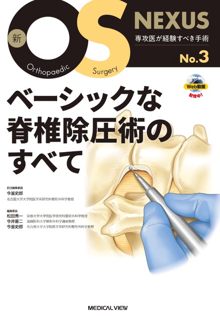 マイクラ 人気アイテム 新OS ベーシックな脊椎除圧術のすべて No.3 NEXUS 健康・医学